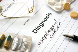 oesophageal cancer