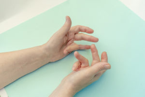 Dupuytren’s Disease