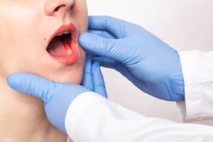 oral cancer